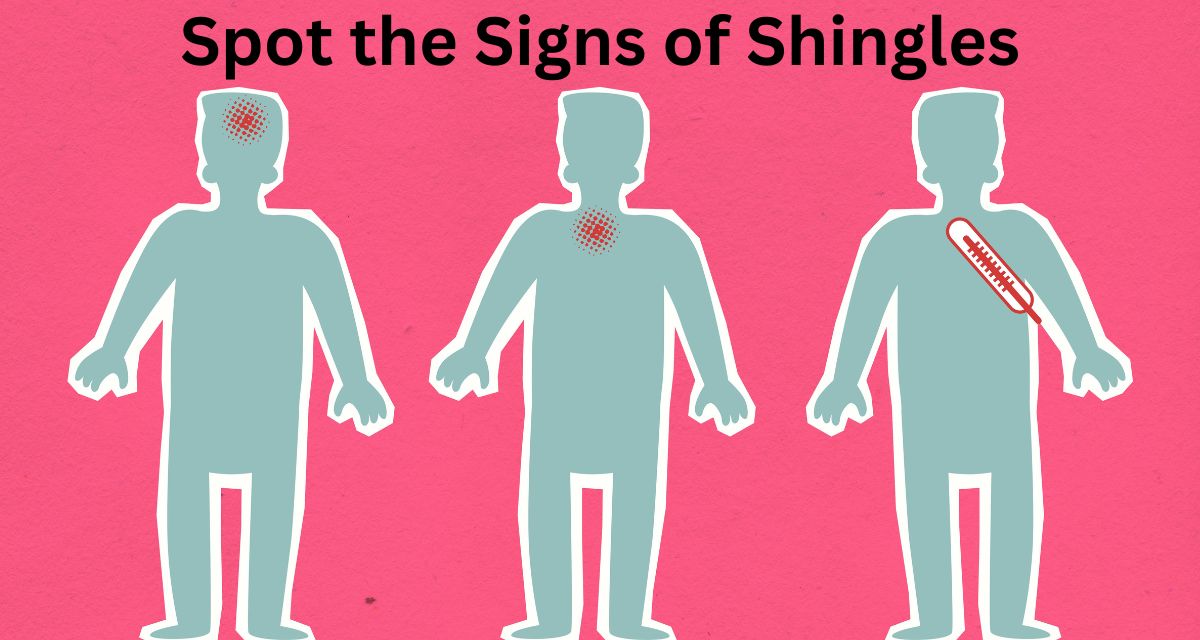 Diagram illustrating the dormant varicella-zoster virus causing chickenpox earlier and shingles later in life.